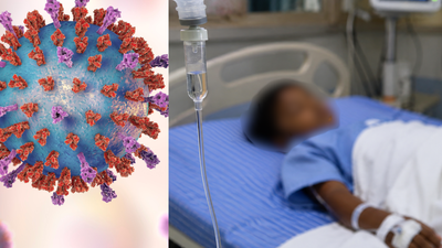 Chandipura virus claims 22 children in Gujarat this monsoon; 35 cases confirmed