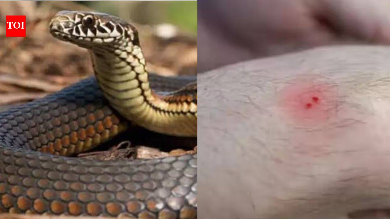 Snake bites MP woman 5 times in 2 minutes; 35 injections save her life