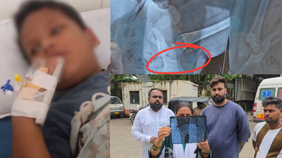 Toddler undergoes surgery after broken syringe needle left inside body at Maharashtra hospital