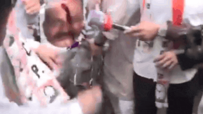 Watch: NCP workers pour dark liquid on Sapkal effigy, protest 'gungi gudiya' remark outside Congress HQ