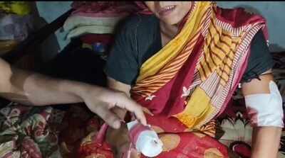 8 injured, four critical after fox attack in Cachar village