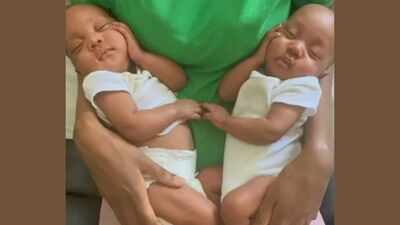 Rare twin girls were born hugging inside the same amniotic sac; after nearly two months in intensive care, they finally went home together