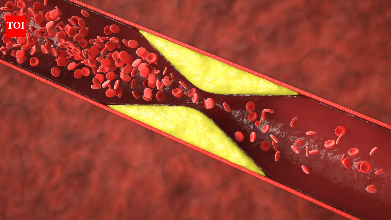 Can you have a heart attack with normal cholesterol? What doctors want you to know