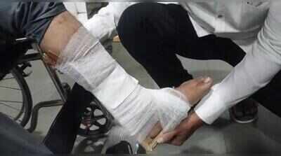 Kalyan-Dombivli Municipal Corporation-run hospital staff use cardboard as splint instead of plaster cast for man’s fractured leg
