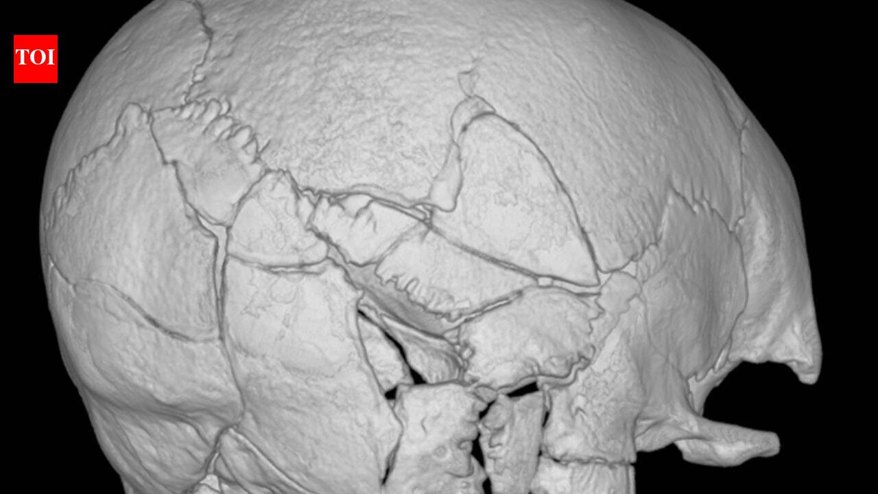 160 plus fractures found in Scottish castle skeleton may be first confirmed trebuchet death