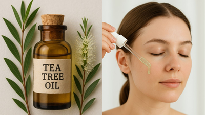 From tea tree to azelaic acid: Which ingredients actually help with monsoon acne and fungal skin problems?