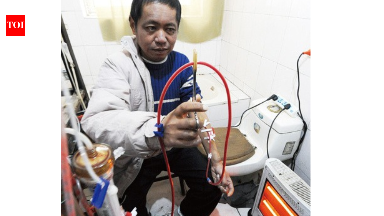 In 2013, a Chinese man who could no longer afford dialysis built his own dialysis machine