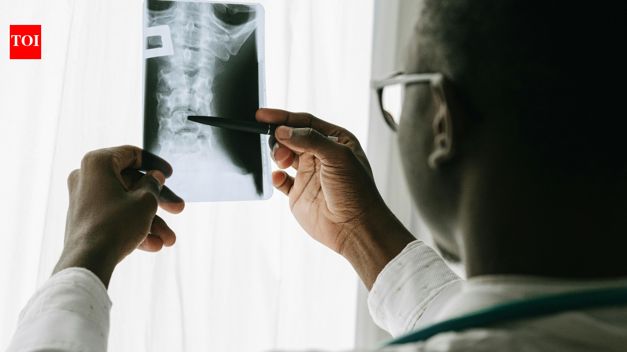Doctors Restore Spine Alignment in Young SMA Patient With Severe Curvature
