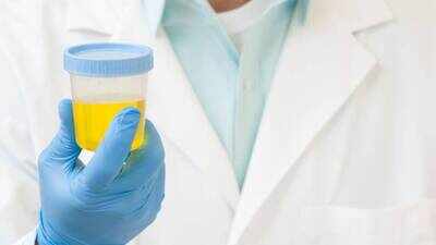 Can human urine help make rocket fuel and support EV battery technology? Scientists develop new way to turn urea into hydrazine
