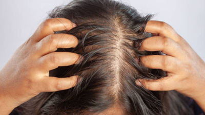 El auge del fitness en la India tiene un coste oculto: un experto revela lo que la creatina podría significar para la línea del cabello