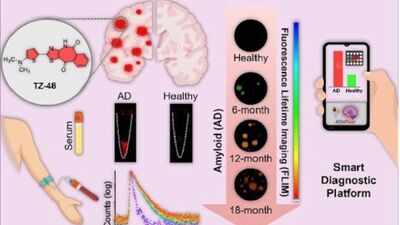 JNCASR team develops smartphone tool to aid Alzheimer's detection