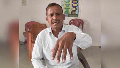 Hazaribag: Home guard alleges assault by Ango police station in-charge, probe ordered