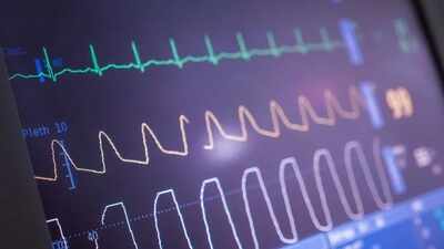 Heart ablation cuts irregular beats, but may not make patients feel better