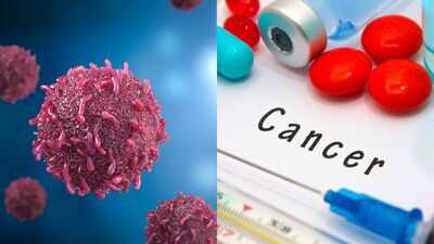 Bowel Cancer before 50: Study reveals key differences in biology and survival