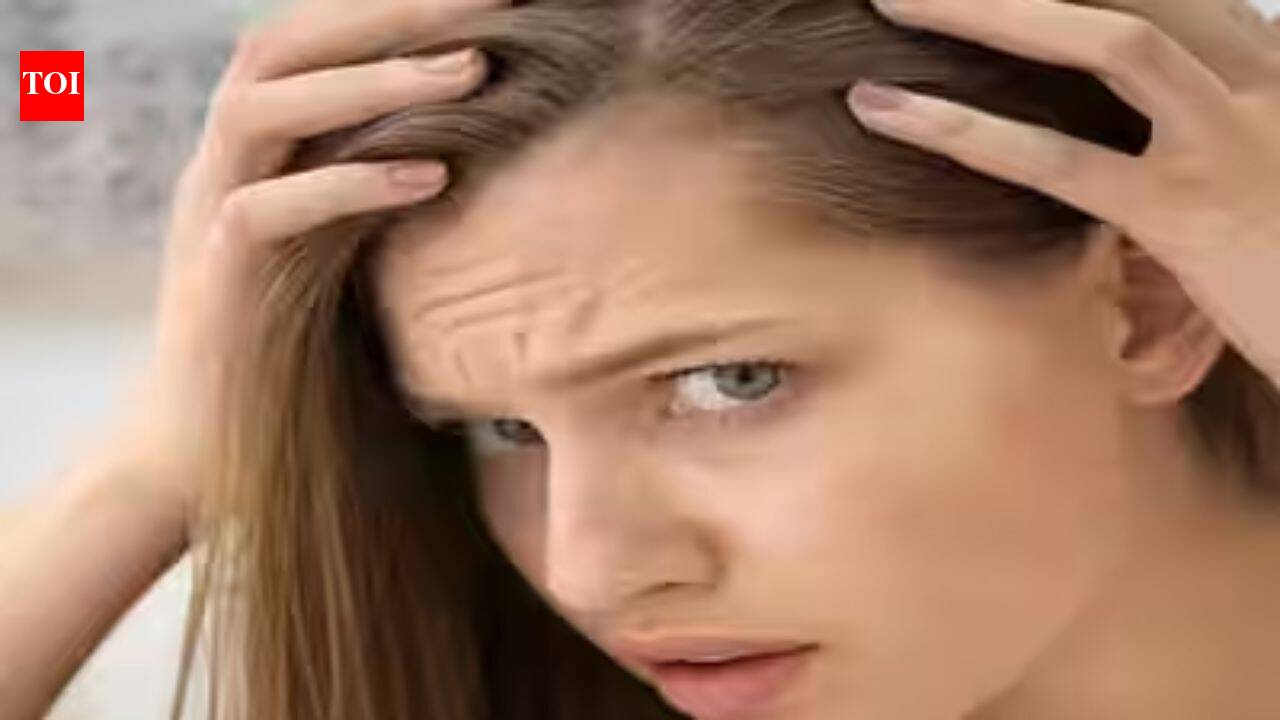A reel deal: Why Gen Z wants a perfect hairline