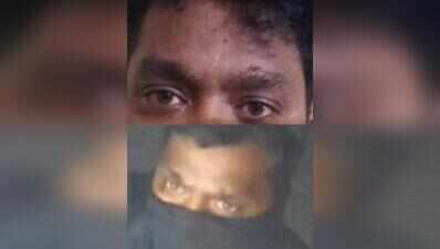 ‘Scar’ helps cops nab burglar from Goa in Jubilee Hills theft case