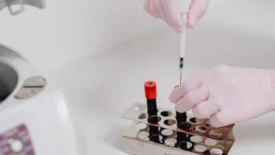 Researchers tested 30 nanometre magnetic particles on 94 blood samples; they detected amoxicillin allergy with 98 percent sensitivity, versus about 17 percent for a standard commercial test