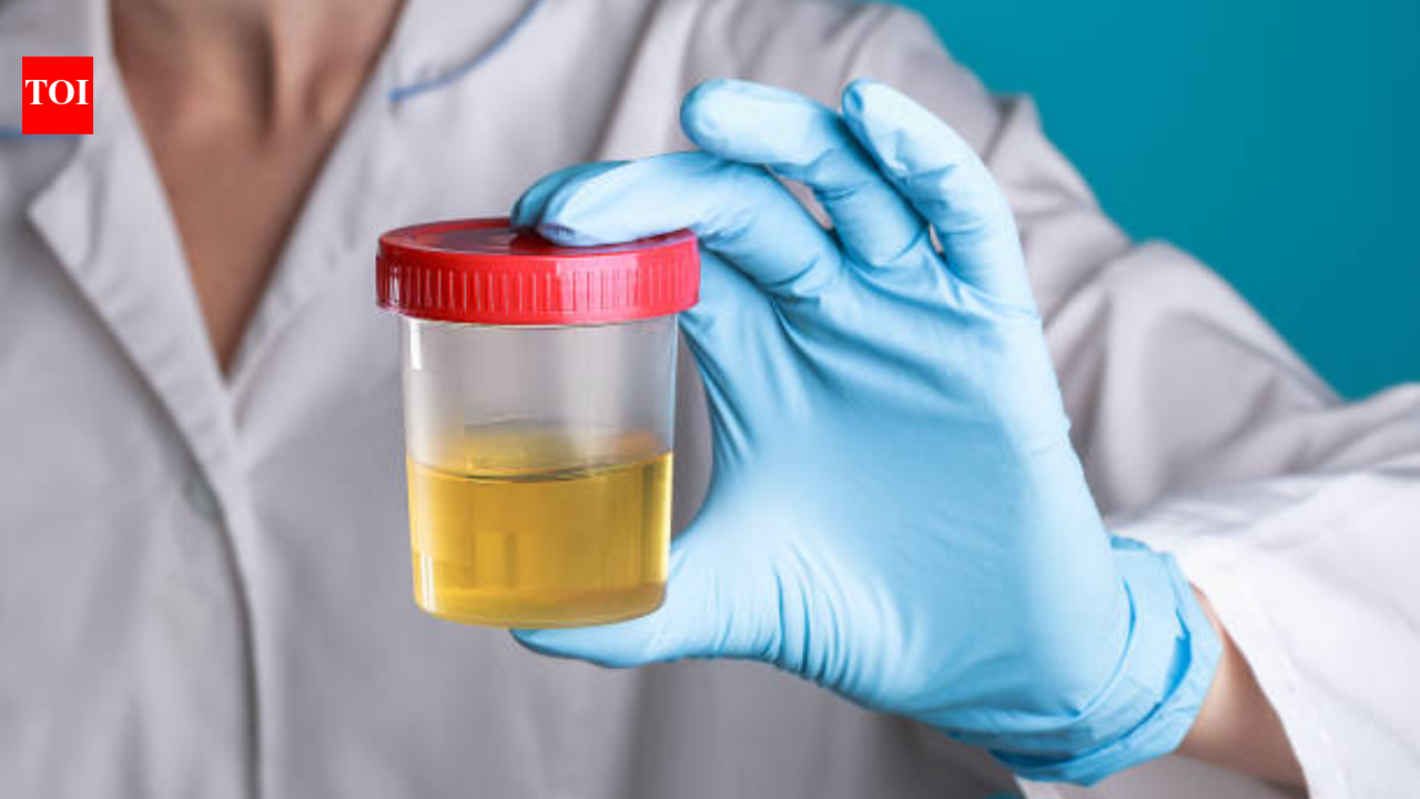 HealthWhat changes in urine appearance can tell yo