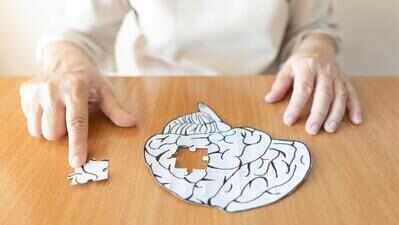PGI to offer low cost confirmatory test for Alzheimer’s