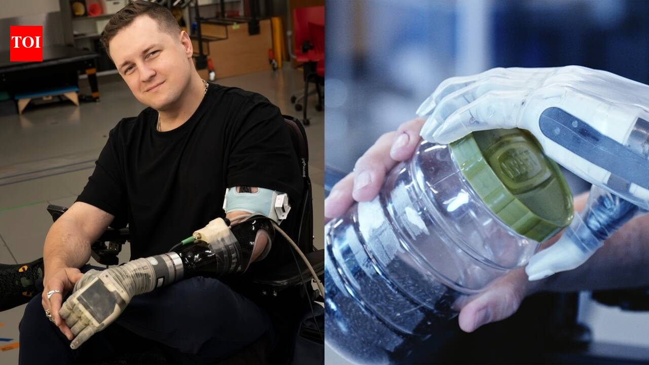 17 years after losing his arm, he can feel again with a bionic limb