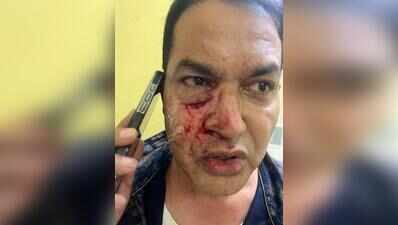Ex-MLA Humayun injured in TMC-BJP clash in S Kolkata