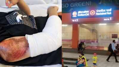 'Stalked, hit deliberately': Delhi woman scooterist claims bikers chased her before crash near Panchsheel Metro Station
