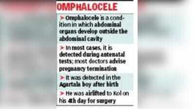 Agartala newborn goes home after abdominal cavity operation