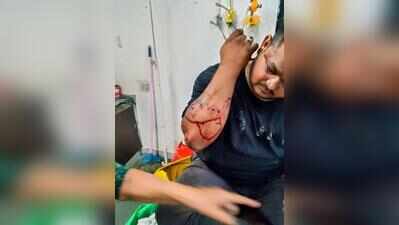 Rickshaw driver attacked by pet dog, hit with chain