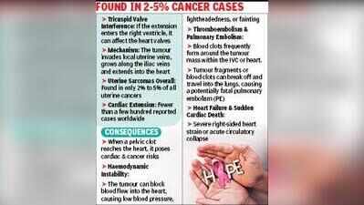 Clot From Uterine Tumour Moves To Heart, Woman Safe After Op