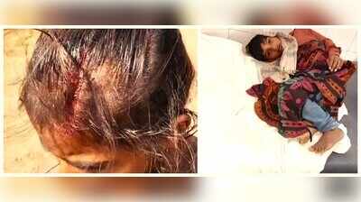 3 kids injured as roof plaster falls in Udaipur school, building locked