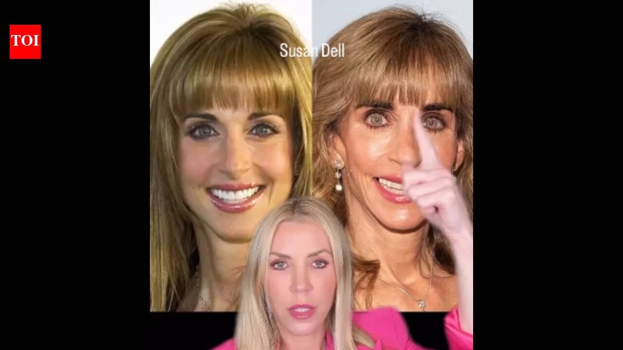 'Is that you': Celebrity cosmetic doctor reacts as Internet can't stop talking about Susan Dell's face while she donates billions