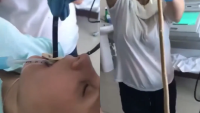 Viral video: Doctors pull out 35 cm-long roundworm from a woman during endoscopy; what is ascariasis?