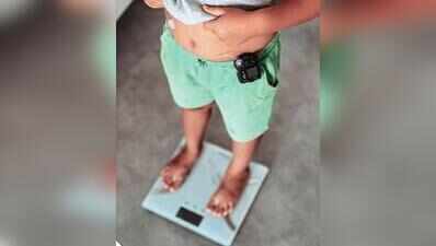 Childhood obesity spreads across income groups, Mumbai’s Wadia hospital sees 300 cases in 3 years