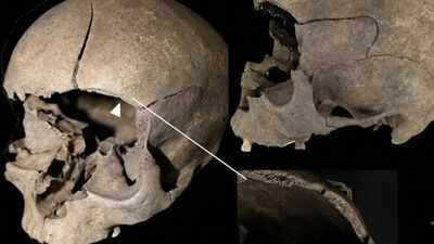 Archaeologists find 19 injuries in 12 people whose remains were placed in houses, wells and pits across Iron and Viking Age Scandinavia