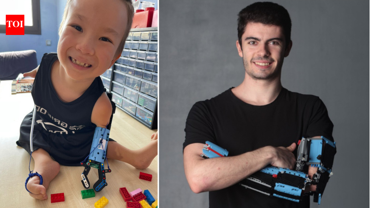 Born with an underdeveloped arm, he built a LEGO prosthetic at 18 to help another boy