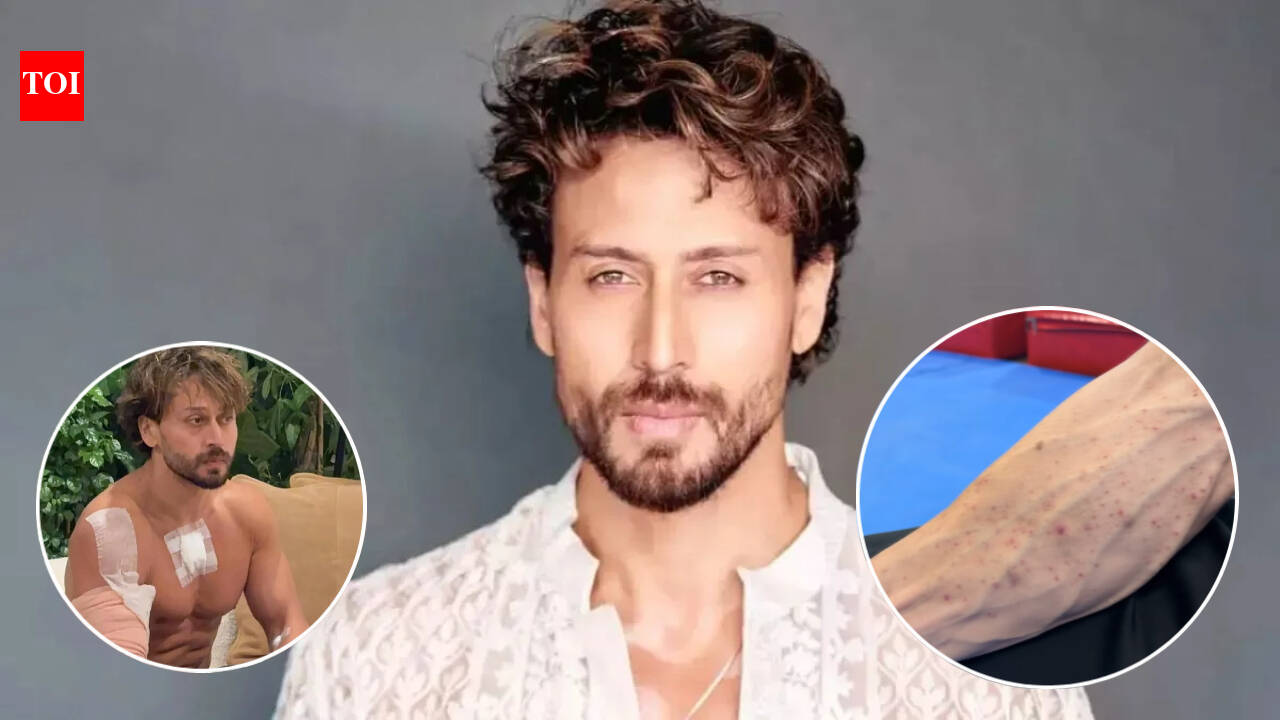 Tiger Shroff's team shares video of gunpowder burn marks on his hand after firing incident