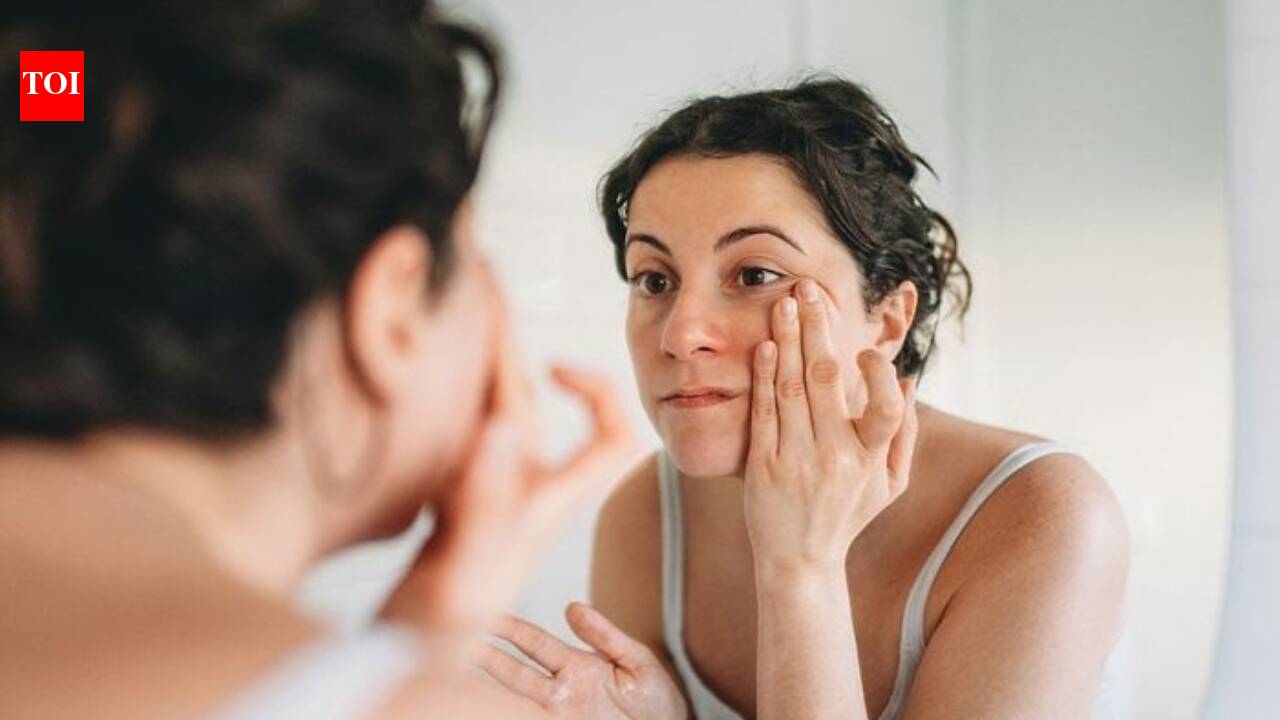 'Ferritin face': 7 warning signs of iron deficiency you shouldn’t ignore