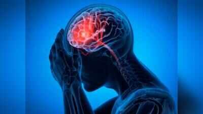 World Stroke Day: More young people falling prey to stroke in Bihar: Doctors
