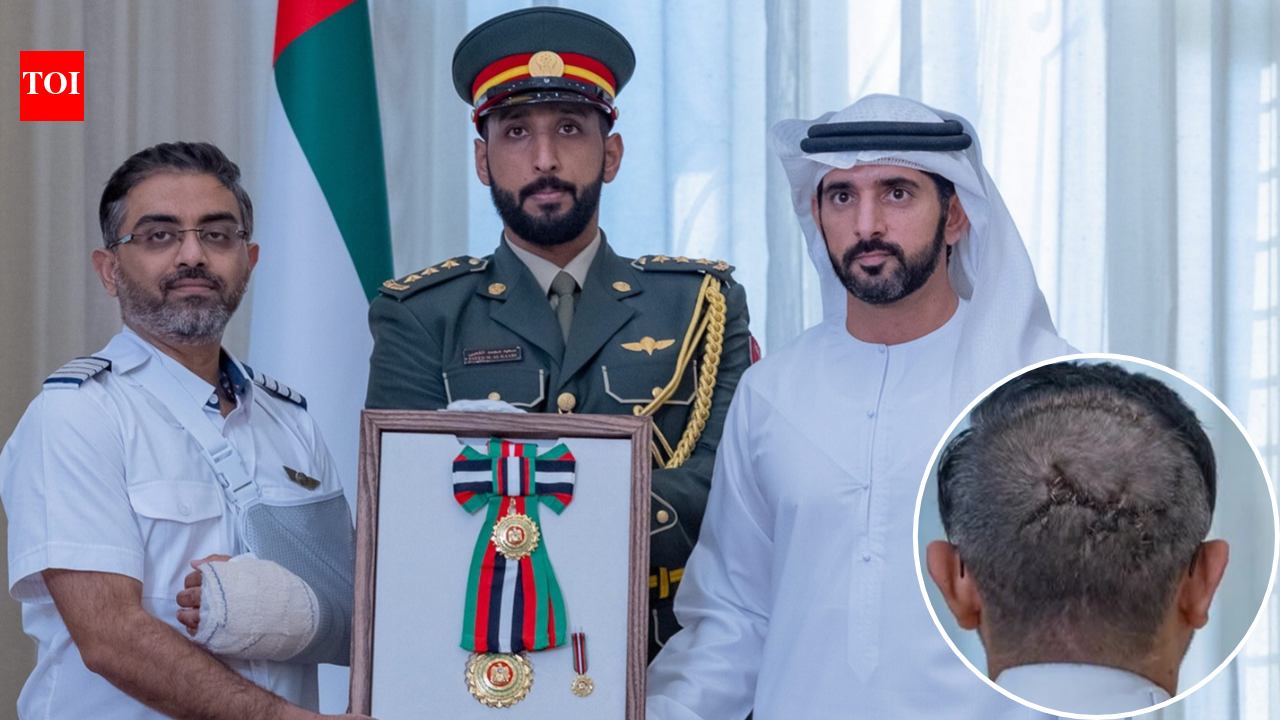 'Battle scars': Massive stitches on Capt Smit's head draw attention as UAE honours him