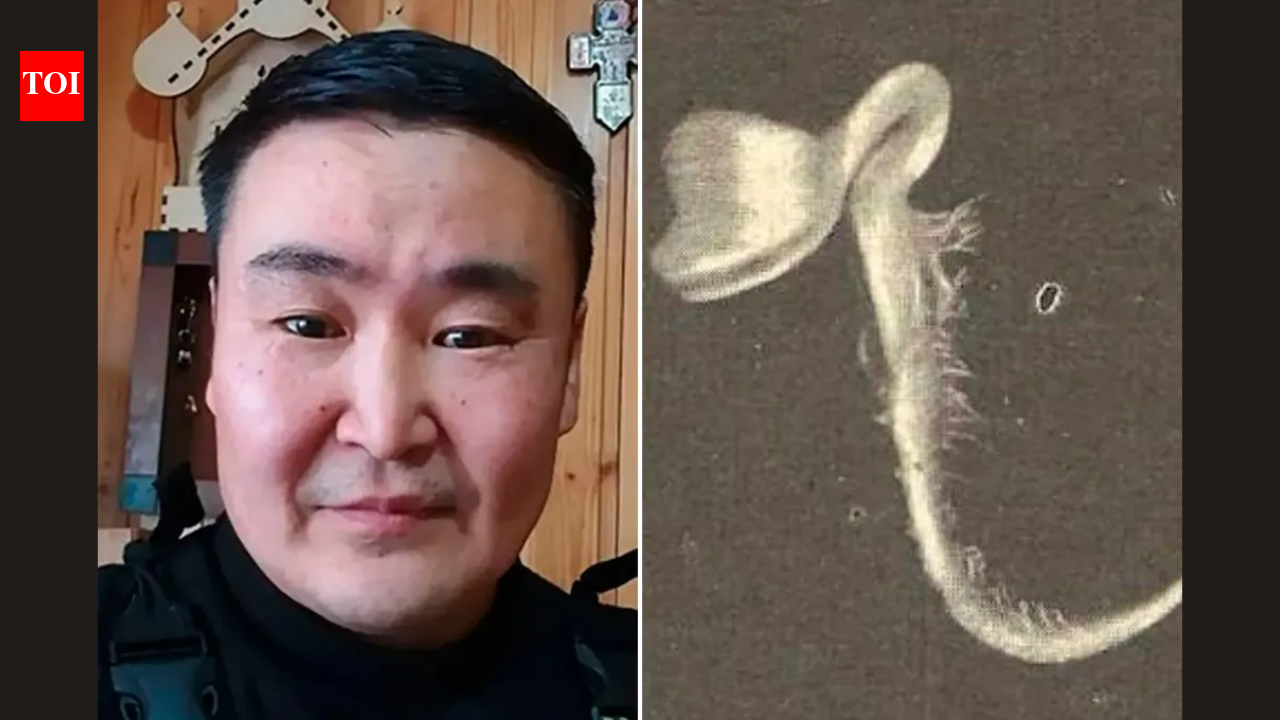 Seed sprouts inside Russian man's eye after branch injury