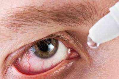 How to prevent conjunctivitis this monsoon