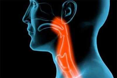 What is throat cancer?