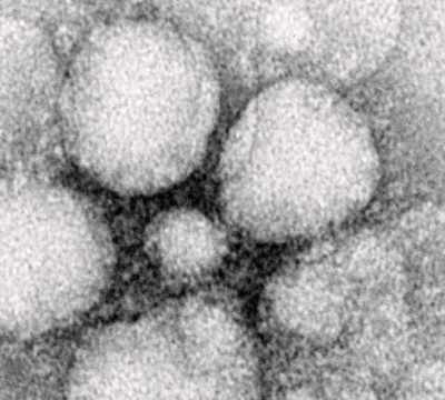 Common virus tied to Alzheimer's: Study