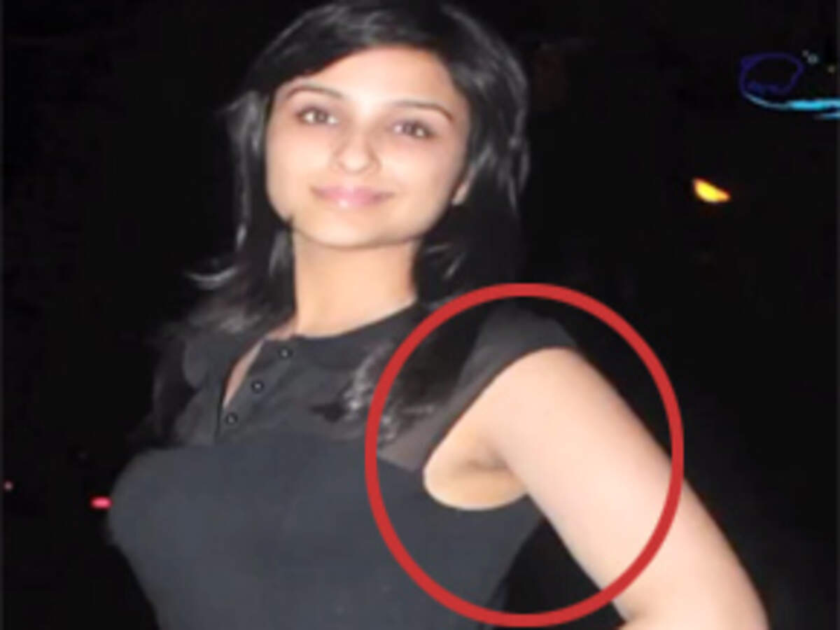 OMG: Parineeti Chopra flaunts her hairy armpits! | Celebs - Times of India Videos OMG: Parineeti Chopra flaunts her hairy armpits! | Celebs - Times of India Videos