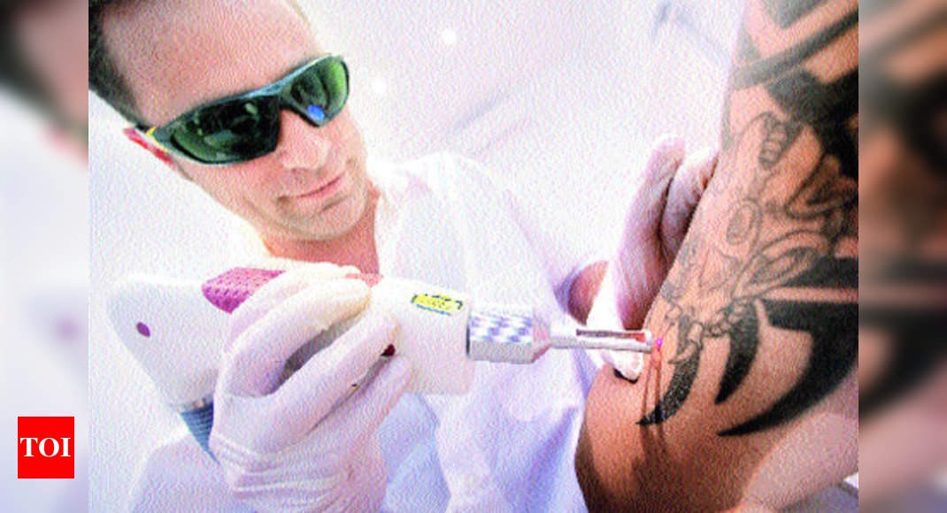 tattoo removal price in chennai