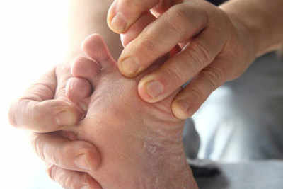 Diabetes care: Diabetes foot self-care