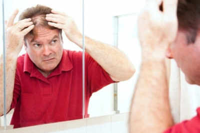 Reasons for patchy hair loss in men