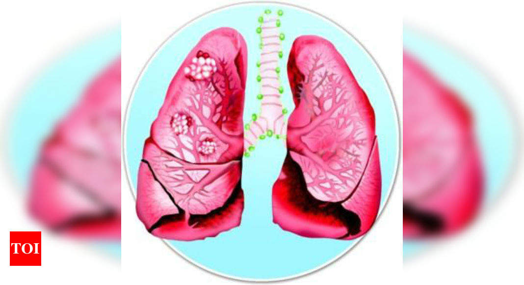 New drug could potentially treat lung cancer Times of India