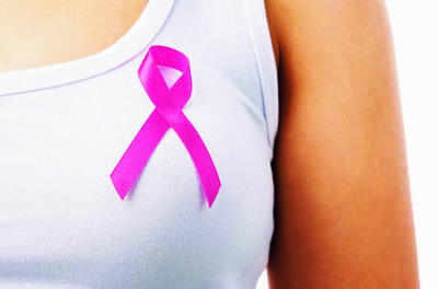 Oncoplastic surgery replacing mastectomy in breast cancer
