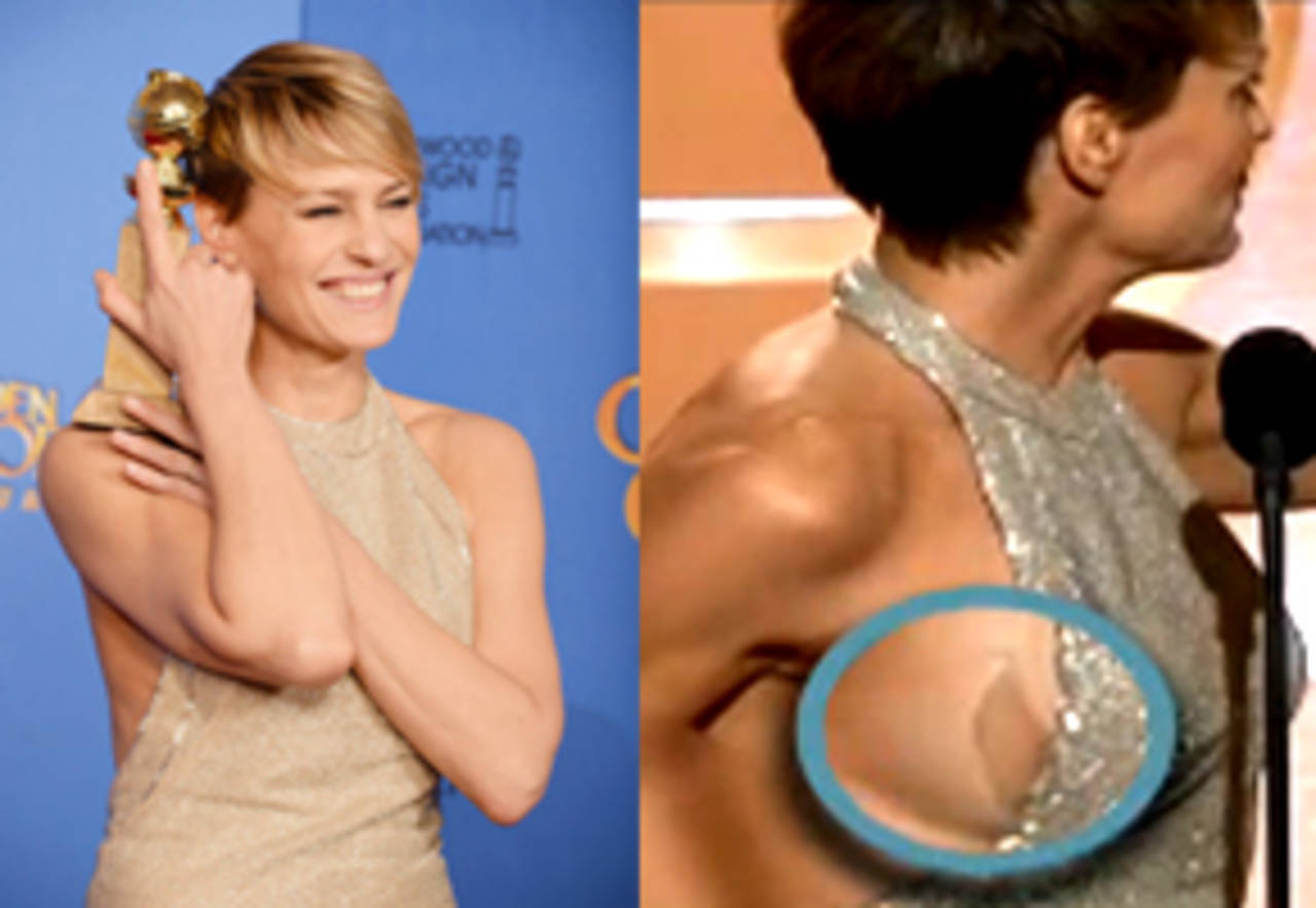 Robin Wright suffers wardrobe malfunction during 2014 Golden Globes